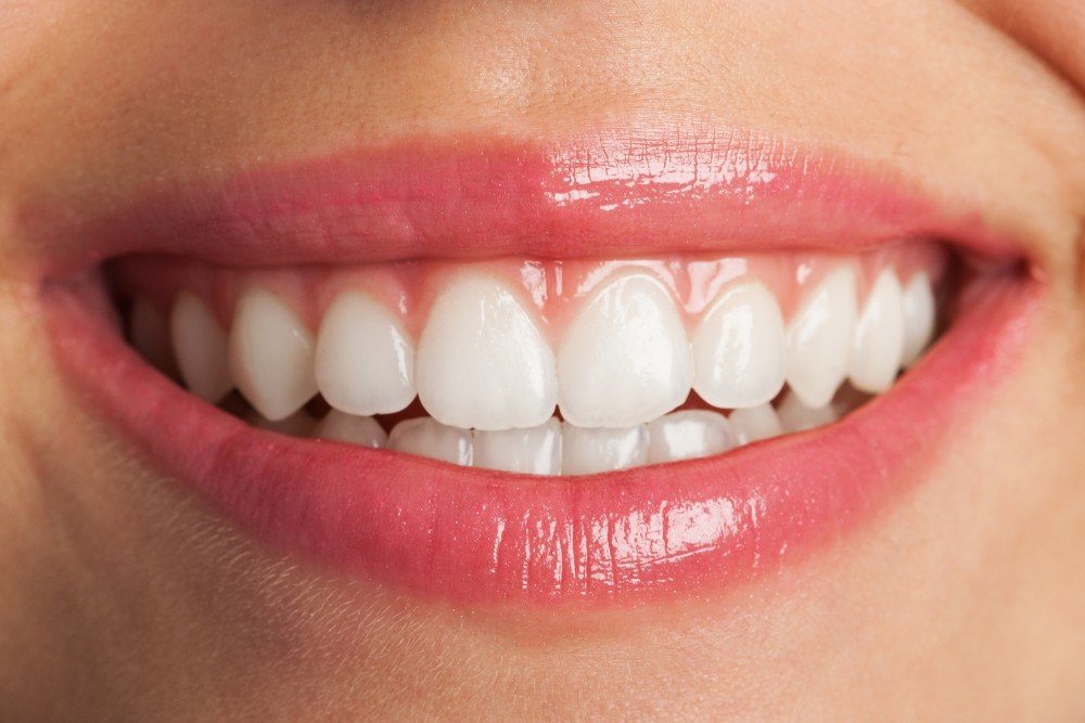 bleaching tooth whitening