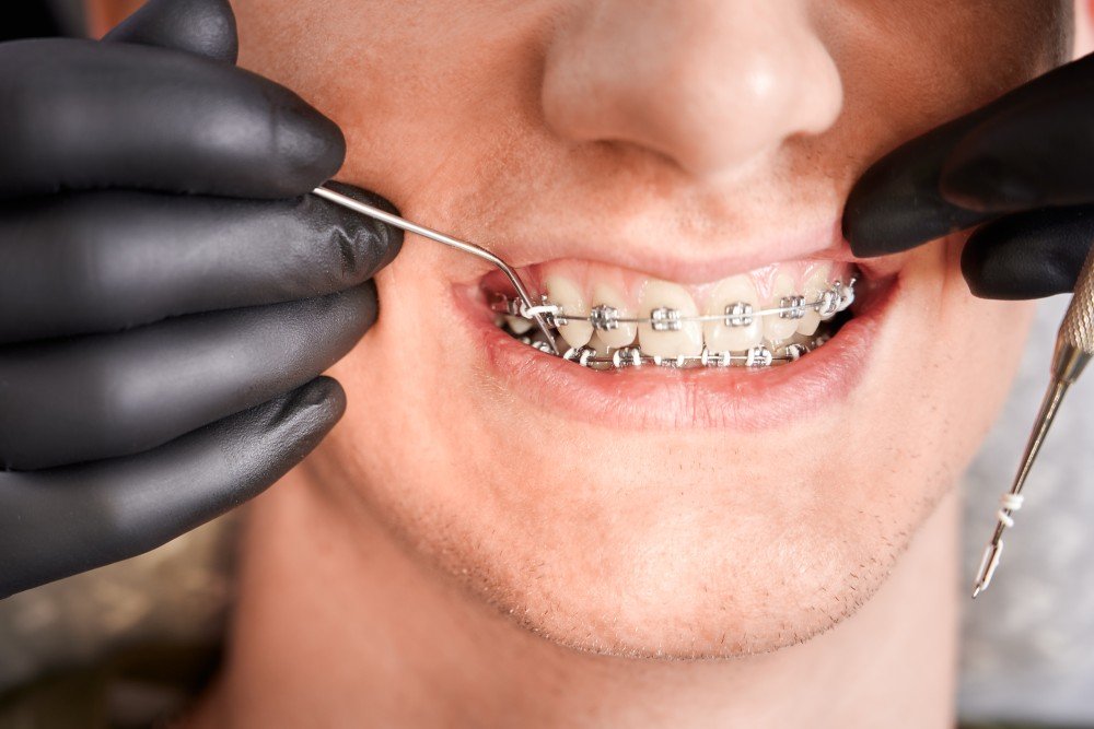 orthodontist