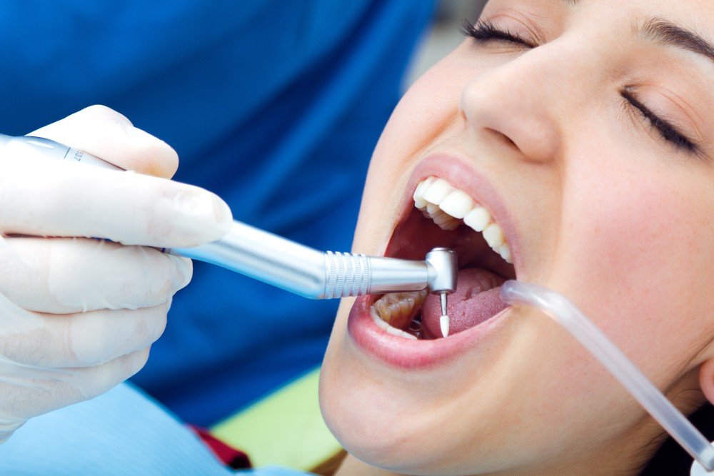 tooth filling
